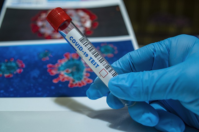 Testovanie pacientov prichádzajúcich k hospitalizácii